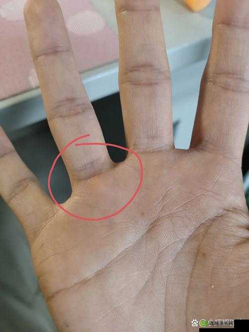 才一根手指头就喊疼是什么意思:探究背后缘由