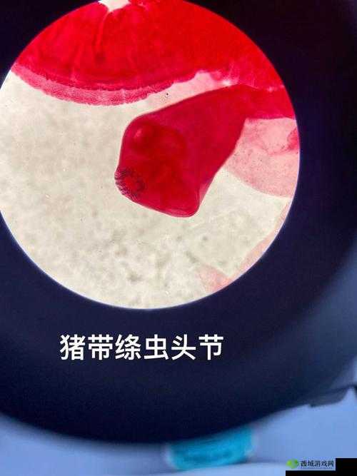 医院计划:猪肉绦虫详症状分析——绦虫感染的全方位解读
