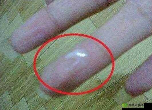 为什么同房后女性会分泌白色分泌物?这种情况正常吗?