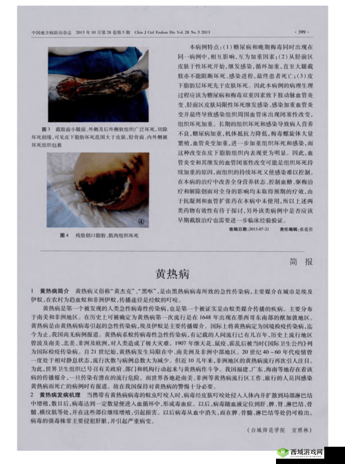 希望之村黄热病怎么治?黄热病治疗处理方法介绍及未来玩法革命预测